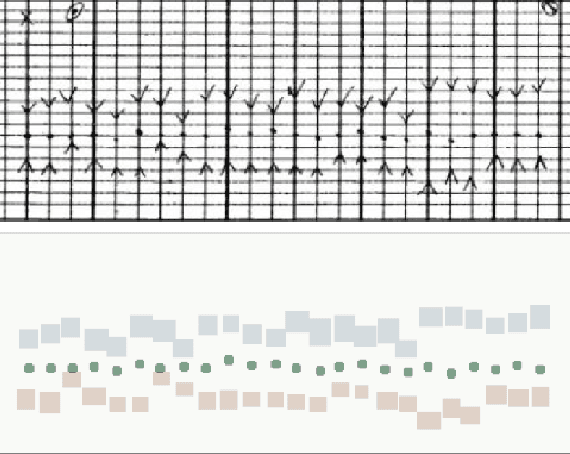 Figure 1 for Hand-drawn Symbol Recognition of Surgical Flowsheet Graphs with Deep Image Segmentation