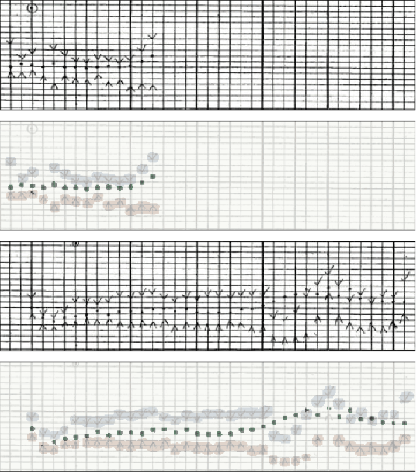 Figure 2 for Hand-drawn Symbol Recognition of Surgical Flowsheet Graphs with Deep Image Segmentation