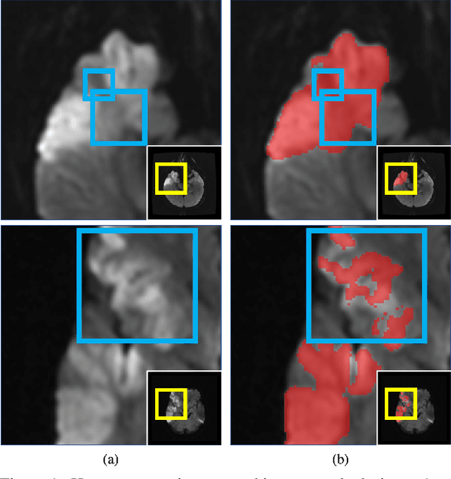 Figure 1 for Hypernet-Ensemble Learning of Segmentation Probability for Medical Image Segmentation with Ambiguous Labels