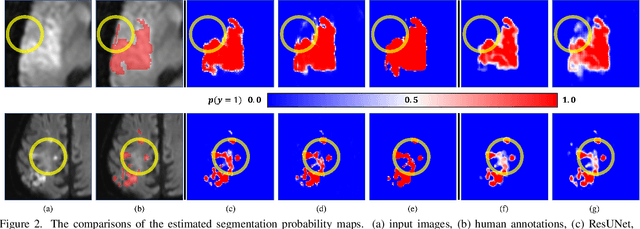 Figure 3 for Hypernet-Ensemble Learning of Segmentation Probability for Medical Image Segmentation with Ambiguous Labels