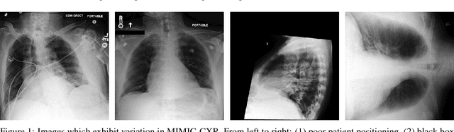 Figure 1 for MIMIC-CXR: A large publicly available database of labeled chest radiographs