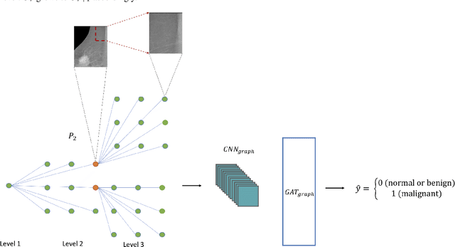 Figure 2 for Zoom in to where it matters: a hierarchical graph based model for mammogram analysis