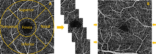 Figure 1 for Automated and Network Structure Preserving Segmentation of Optical Coherence Tomography Angiograms
