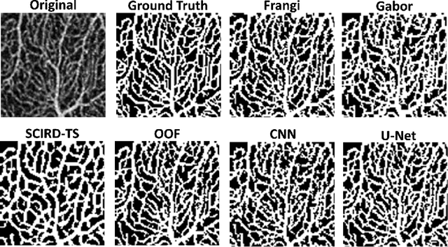 Figure 3 for Automated and Network Structure Preserving Segmentation of Optical Coherence Tomography Angiograms