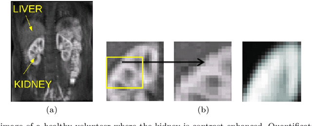Figure 1 for Automatic Delineation of Kidney Region in DCE-MRI