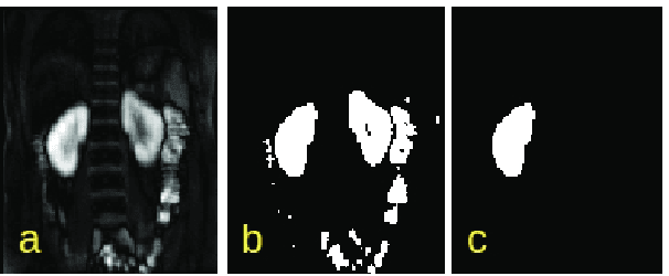 Figure 2 for Automatic Delineation of Kidney Region in DCE-MRI