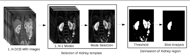 Figure 3 for Automatic Delineation of Kidney Region in DCE-MRI