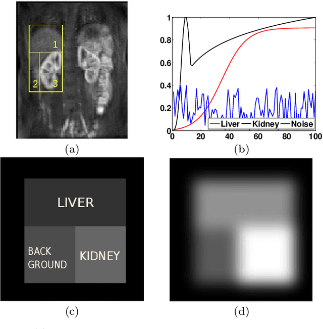 Figure 4 for Automatic Delineation of Kidney Region in DCE-MRI