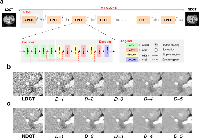 Figure 1 for Can Deep Learning Outperform Modern Commercial CT Image Reconstruction Methods?