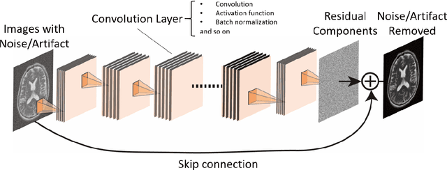 Figure 1 for Review: Noise and artifact reduction for MRI using deep learning
