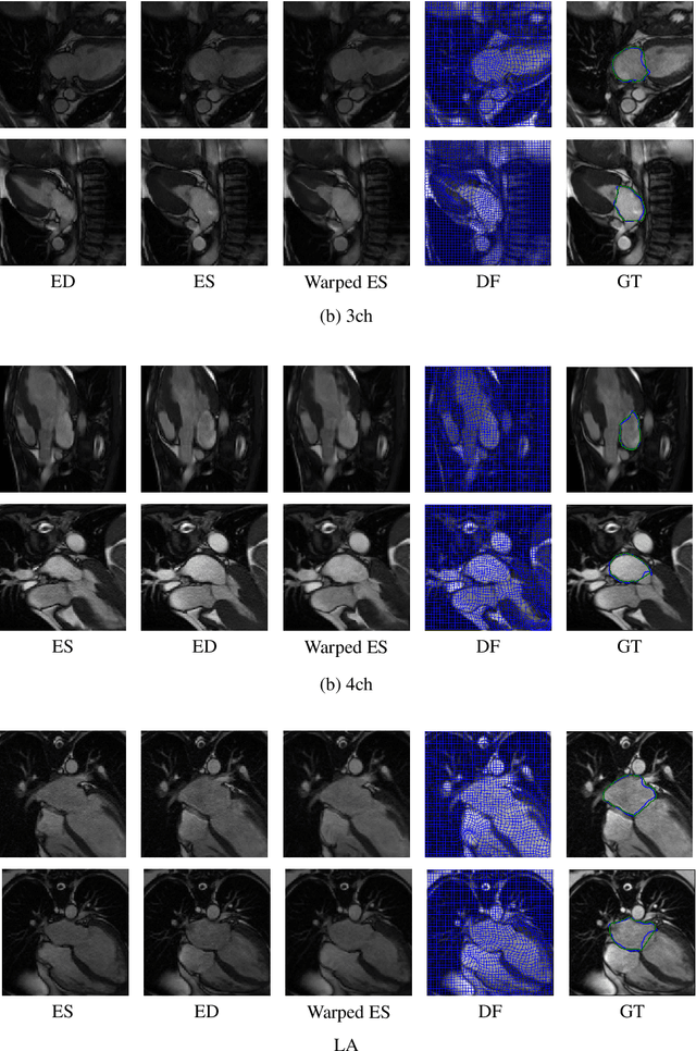 Figure 4 for Unsupervised diffeomorphic cardiac image registration using parameterization of the deformation field