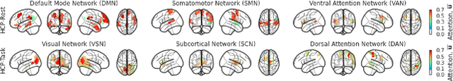 Figure 4 for DBGSL: Dynamic Brain Graph Structure Learning