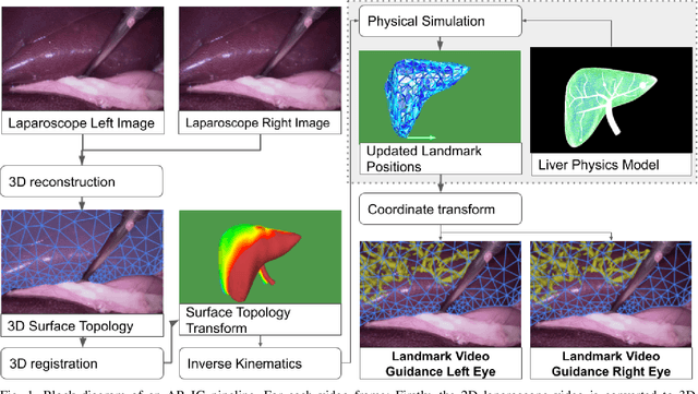 Figure 1 for Patient Specific Biomechanics Are Clinically Significant In Accurate Computer Aided Surgical Image Guidance