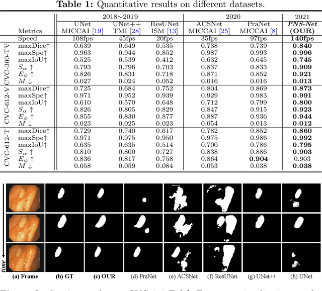 Figure 2 for Progressively Normalized Self-Attention Network for Video Polyp Segmentation