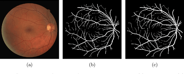 Figure 1 for Deep Dilated Convolutional Nets for the Automatic Segmentation of Retinal Vessels