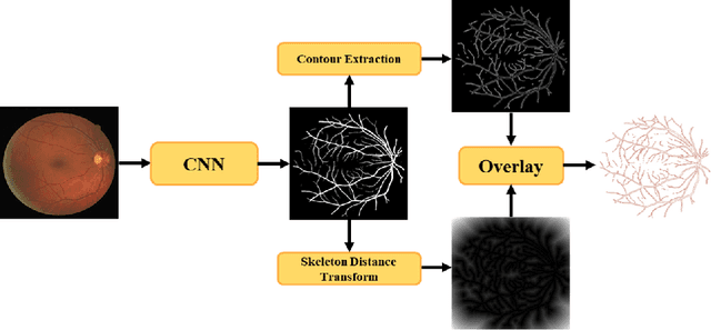 Figure 4 for Deep Dilated Convolutional Nets for the Automatic Segmentation of Retinal Vessels