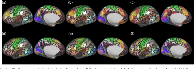 Figure 3 for Surface Vision Transformers: Flexible Attention-Based Modelling of Biomedical Surfaces