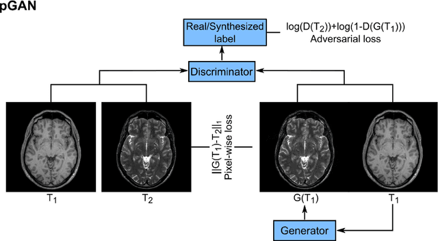 Figure 1 for Image Synthesis in Multi-Contrast MRI with Conditional Generative Adversarial Networks