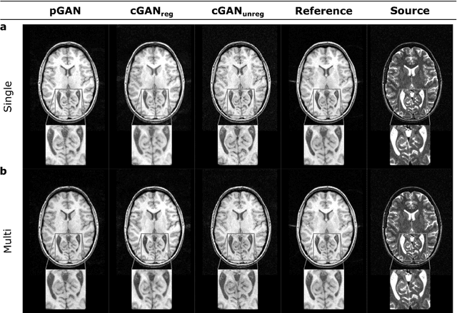 Figure 4 for Image Synthesis in Multi-Contrast MRI with Conditional Generative Adversarial Networks