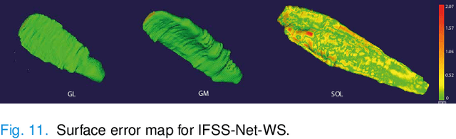 Figure 3 for IFSS-Net: Interactive Few-Shot Siamese Network for Faster Muscles Segmentation and Propagation in 3-D Freehand Ultrasound