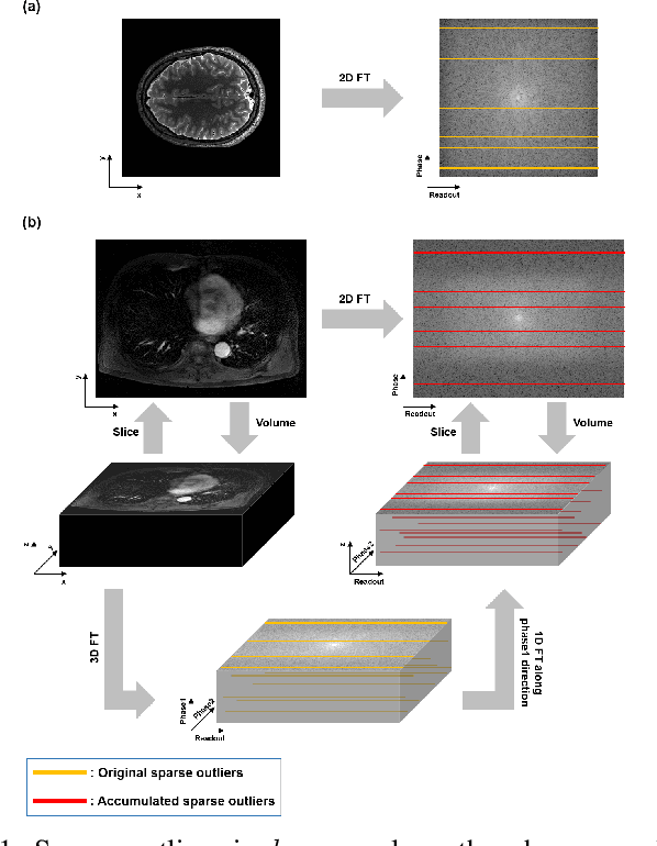 Figure 1 for Unsupervised MR Motion Artifact Deep Learning using Outlier-Rejecting Bootstrap Aggregation