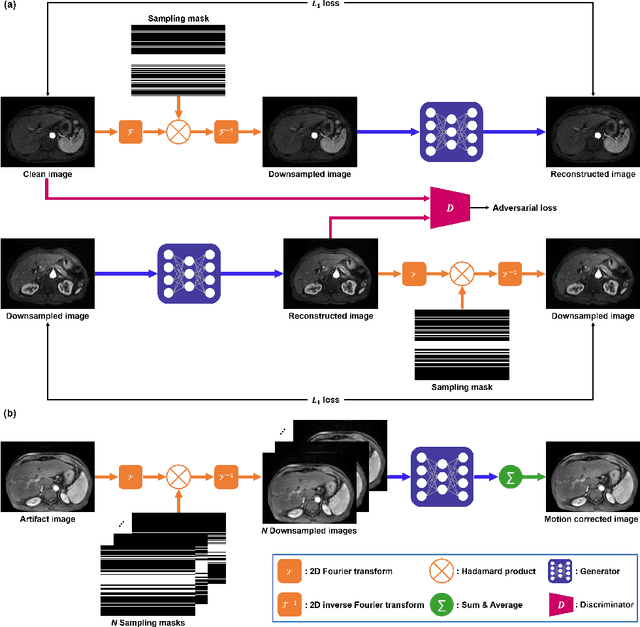 Figure 2 for Unsupervised MR Motion Artifact Deep Learning using Outlier-Rejecting Bootstrap Aggregation