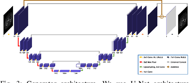 Figure 3 for Unsupervised MR Motion Artifact Deep Learning using Outlier-Rejecting Bootstrap Aggregation