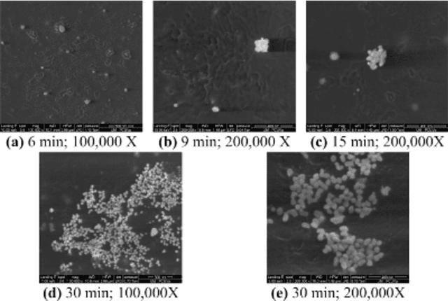 Figure 2 for Segmentation of scanning electron microscopy images from natural rubber samples with gold nanoparticles using starlet wavelets