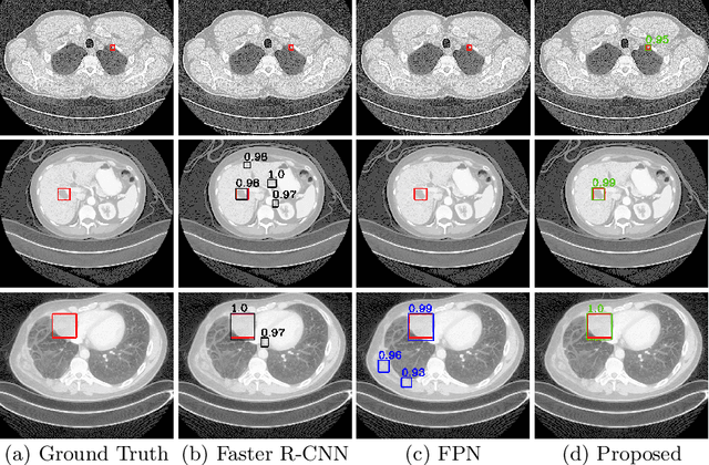 Figure 1 for Attentive CT Lesion Detection Using Deep Pyramid Inference with Multi-Scale Booster