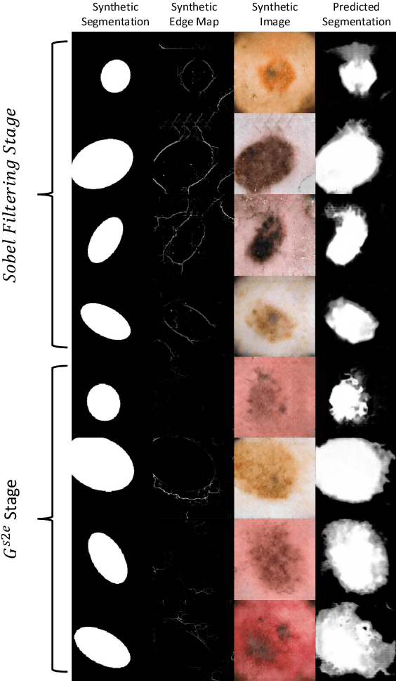 Figure 3 for TricycleGAN: Unsupervised Image Synthesis and Segmentation Based on Shape Priors