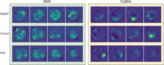 Figure 4 for Brain-Aware Replacements for Supervised Contrastive Learning