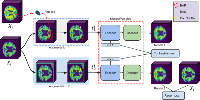 Figure 1 for Brain-Aware Replacements for Supervised Contrastive Learning