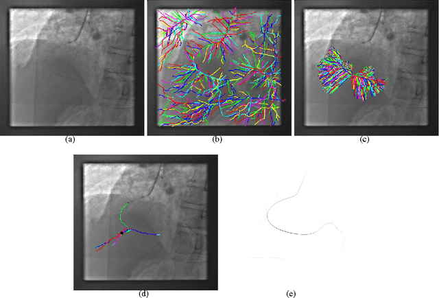 Figure 4 for A graph-based mathematical morphology reader