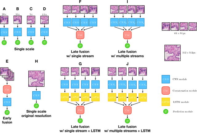 Figure 4 for Improving Whole Slide Segmentation Through Visual Context - A Systematic Study