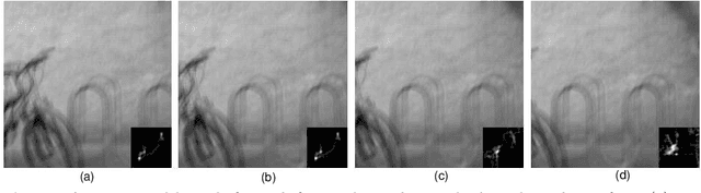 Figure 2 for Select Good Regions for Deblurring based on Convolutional Neural Networks