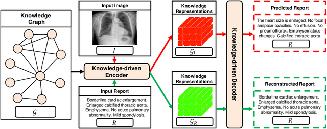 Figure 1 for Auto-Encoding Knowledge Graph for Unsupervised Medical Report Generation