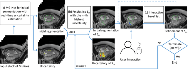 Figure 1 for Uncertainty-Guided Efficient Interactive Refinement of Fetal Brain Segmentation from Stacks of MRI Slices