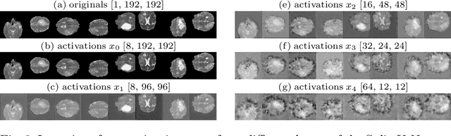 Figure 2 for Split-U-Net: Preventing Data Leakage in Split Learning for Collaborative Multi-Modal Brain Tumor Segmentation