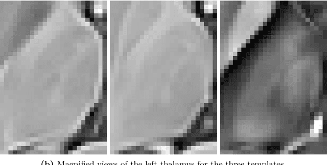 Figure 1 for A multi-contrast MRI approach to thalamus segmentation