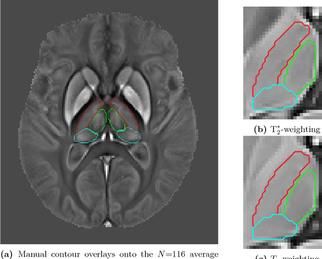 Figure 3 for A multi-contrast MRI approach to thalamus segmentation