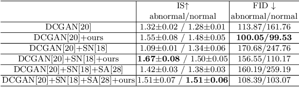 Figure 2 for Realistic Ultrasound Image Synthesis for Improved Classification of Liver Disease
