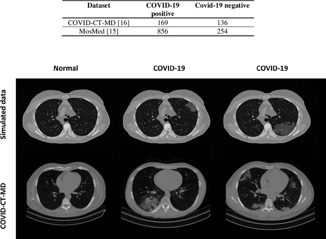 Figure 3 for Virtual vs. Reality: External Validation of COVID-19 Classifiers using XCAT Phantoms for Chest Computed Tomography