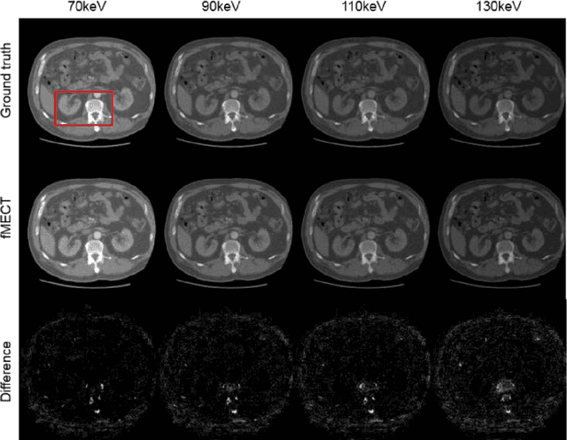 Figure 2 for Direct Energy-resolving CT Imaging via Energy-integrating CT images using a Unified Generative Adversarial Network