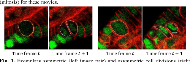Figure 1 for Mitosis Detection in Intestinal Crypt Images with Hough Forest and Conditional Random Fields