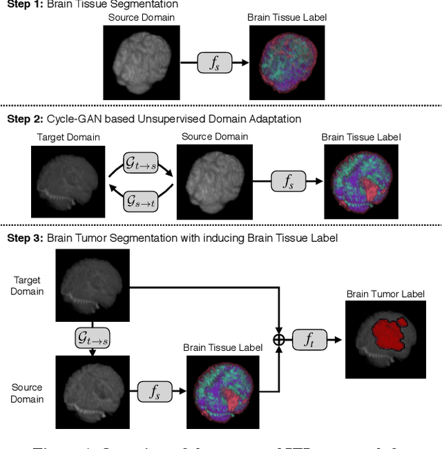 Figure 1 for An Inductive Transfer Learning Approach using Cycle-consistent Adversarial Domain Adaptation with Application to Brain Tumor Segmentation