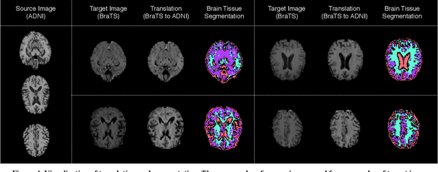 Figure 4 for An Inductive Transfer Learning Approach using Cycle-consistent Adversarial Domain Adaptation with Application to Brain Tumor Segmentation