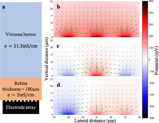 Figure 1 for Real-Time Optimization of the Current Steering for Visual Prosthesis