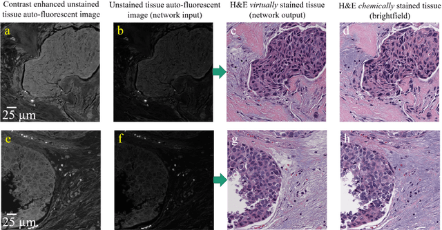 Figure 3 for Deep learning-based virtual histology staining using auto-fluorescence of label-free tissue