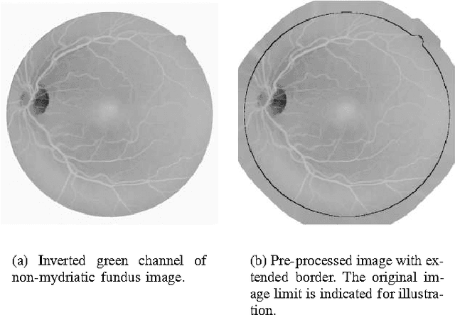 Figure 1 for Retinal Vessel Segmentation Using the 2-D Morlet Wavelet and Supervised Classification