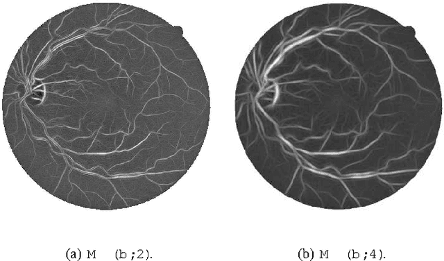 Figure 3 for Retinal Vessel Segmentation Using the 2-D Morlet Wavelet and Supervised Classification